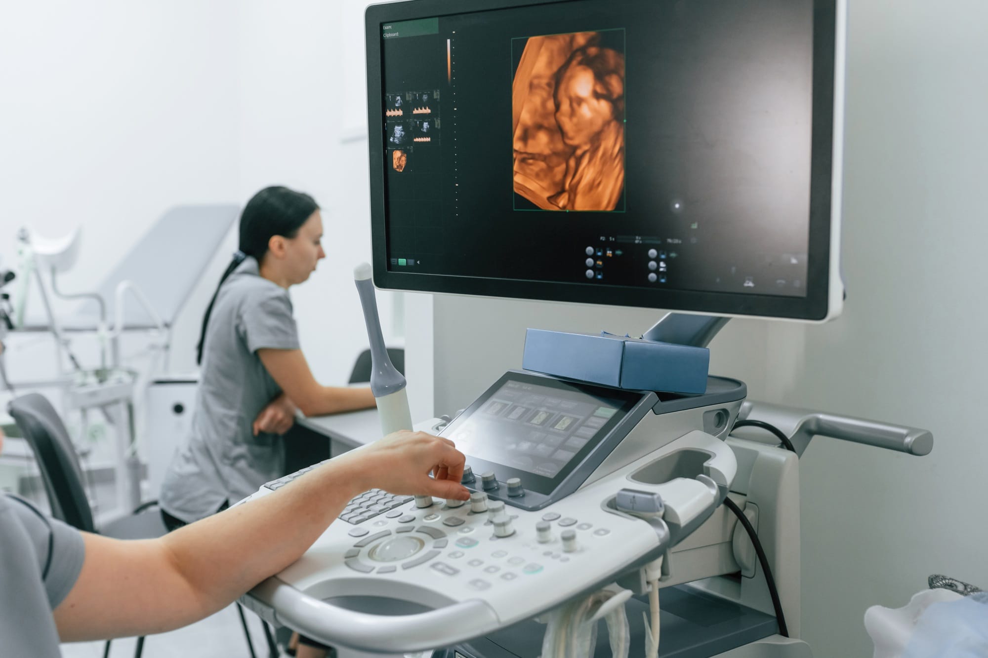 doing an ultrasound scan of the belly of a pregnant woman. Display with little baby