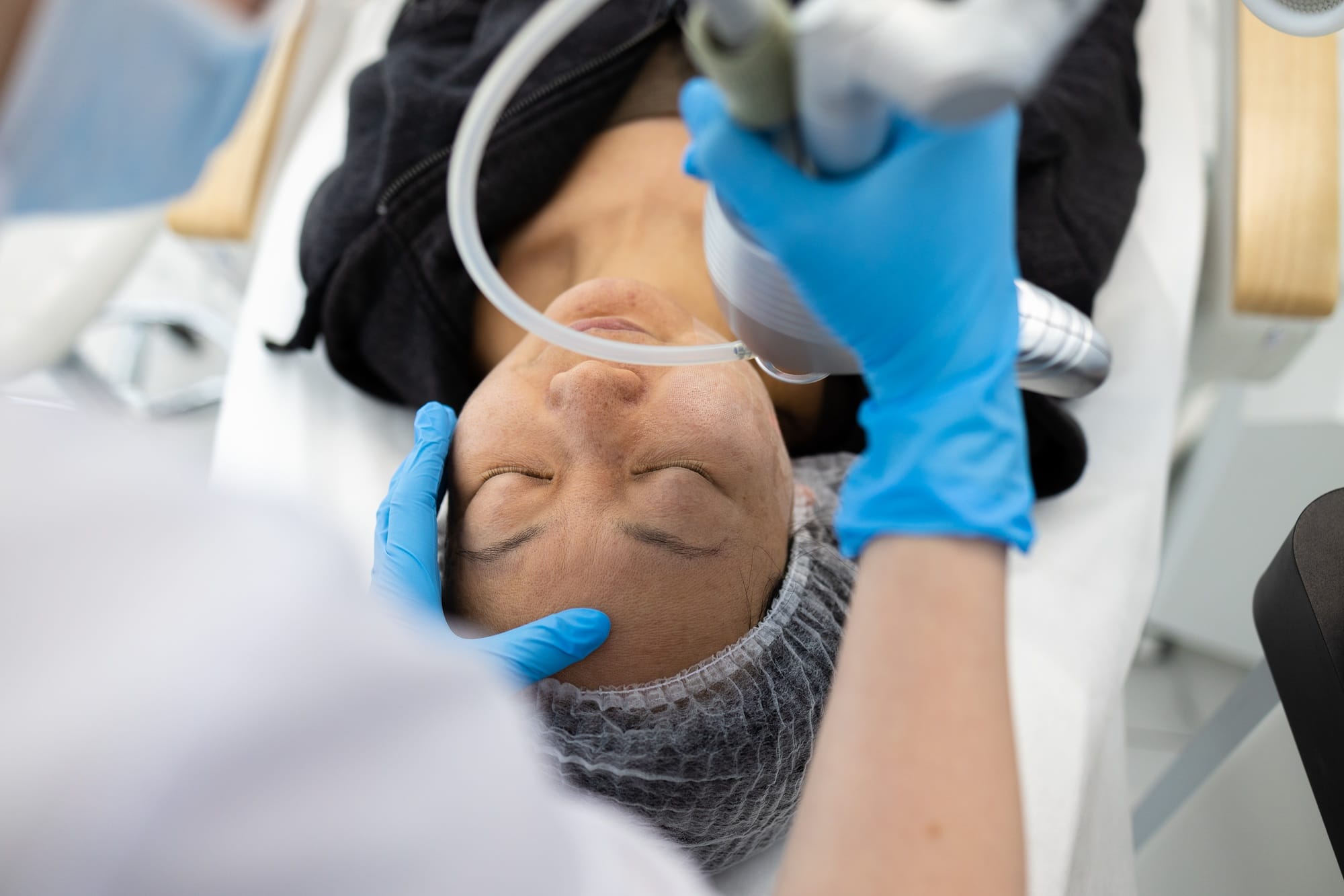 Face skin care. Asian woman getting facial laser treatment in clinic.