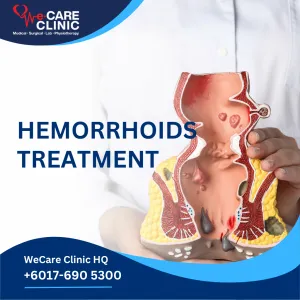 Hemorrhoids Treatment