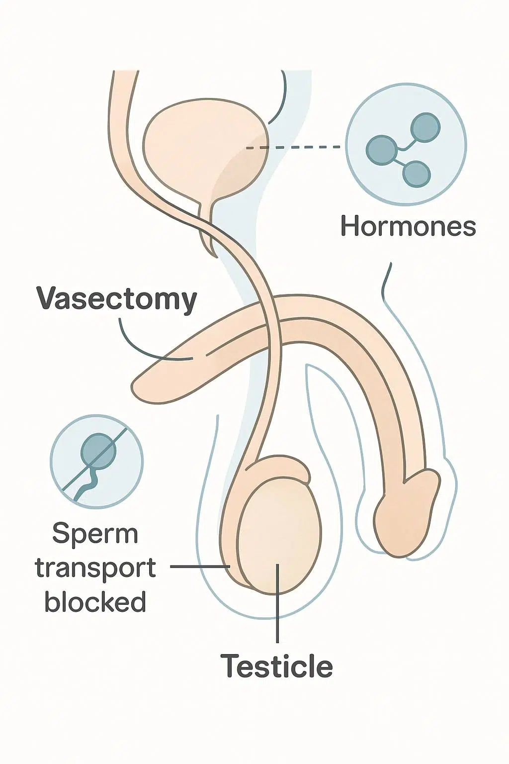 Medical illustration showing male reproductive system with vas deferens and hormonal flow indicating normal hormone production after vasectomy